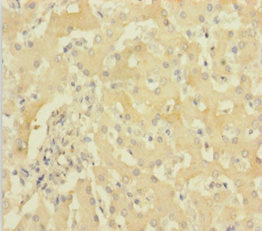 CSB-PA010155HA01HU IHC