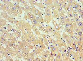 CSB-PA891791ESR1HU IHC-2
