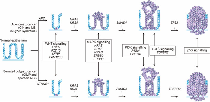 息肉到結(jié)直腸癌的演變序列